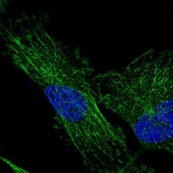 TMEM200C Antibody, Novus Biologicals:Antibodies:Primary Antibodies